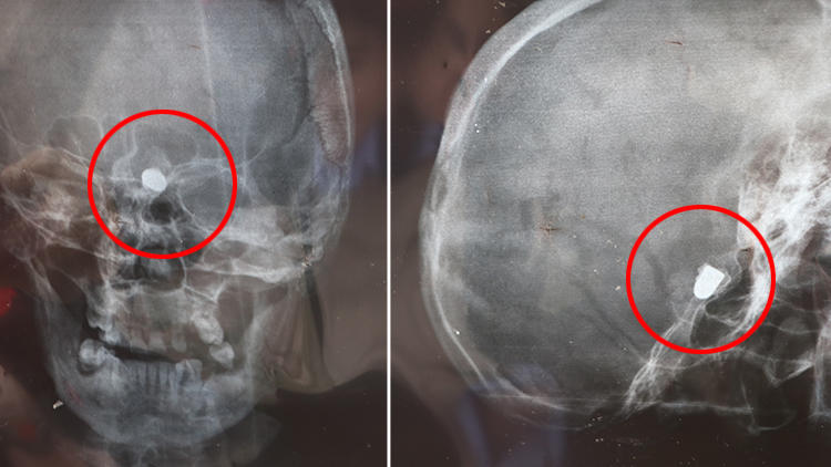 Görenler hayret ediyor… 45 yıldır bu korkuyla yaşıyor